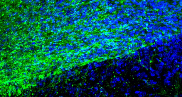 Sclerosi multipla_ nuova luce sul ruolo della microglia nella riparazione della mielina